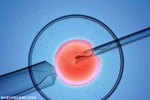 关于景泰生殖